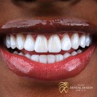 Dental Design Smile Miami image 7