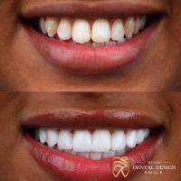 Dental Design Smile Miami image 5