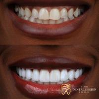 Dental Design Smile Miami image 3