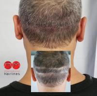International Hairlines image 3