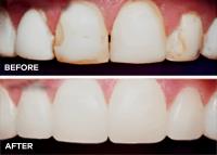 Alvarez Family Dentistry image 4