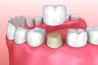 Alvarez Family Dentistry image 7