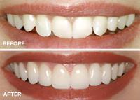 Alvarez Family Dentistry image 5