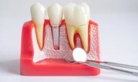 Alvarez Family Dentistry image 3