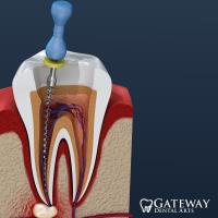 Gateway Dental Arts-Dr Richard Austin-DDS Dental image 5