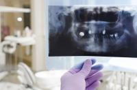 New River Valley Dental Care image 4