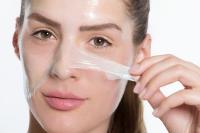 Chemical Peels For Acne Scars: Pros And Cons image 5