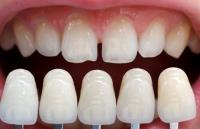 The Lakewood Dentist image 2