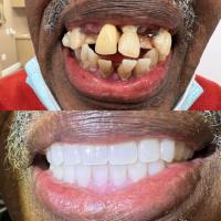 MR Dental Aesthetics image 6