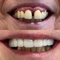 MR Dental Aesthetics image 7