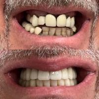 MR Dental Aesthetics image 9