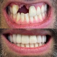 MR Dental Aesthetics image 5