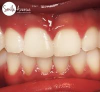Katy Dentist | Smile Avenue Family Dentistry image 3