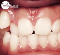 Katy Dentist | Smile Avenue Family Dentistry image 1