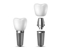 Georgia Implants and Dentures image 7