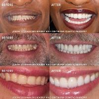 Dr. Joseph Goodman | Beverly Hills Dentist image 3
