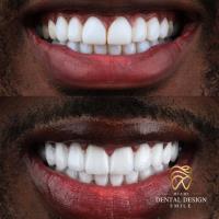 Dental Design Smile Miami image 9