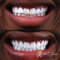 Dental Design Smile Miami image 7