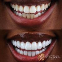 Dental Design Smile Miami image 10