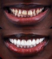 Dental Design Smile Miami image 3