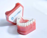 Invisalign and Braces in Orange County image 2