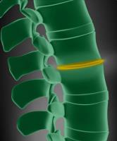 New York Orthopaedic Spinal Associates image 4