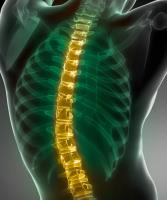 New York Orthopaedic Spinal Associates image 7