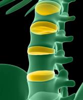 New York Orthopaedic Spinal Associates image 6