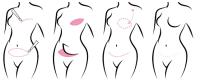 The Center for Natural Breast Reconstruction image 9