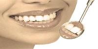 Dental Implant Crown Restoration Williamsburg image 5