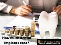Shahbazyan DDS Cosmetic & General Dentistry image 2