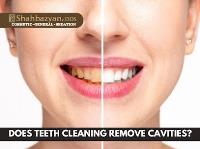 Shahbazyan DDS Cosmetic & General Dentistry image 5