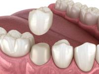 Palmetto Family and Cosmetic Dentistry of Columbia image 3