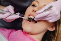 Dental restoration pros image 1