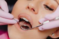 Dental restoration pros image 2