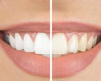 Giant Smiles Dental: Gregory Ray DDS image 2