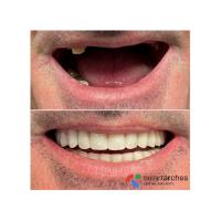 Smart Arches Dental Implants - New York image 1