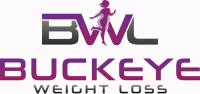 Buckeye Weight Loss image 1
