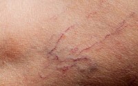 Columbus Vascular Vein & Aesthetics image 1