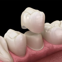 Biltmore Cosmetic & Restorative Dentistry Phoenix image 4