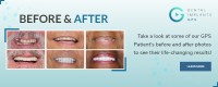 Dental Implants GPS image 4