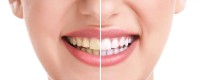 Pinole Hills Dental image 3