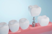 Maidu Dental image 3