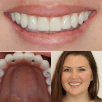 4M Dental Implant Center image 2