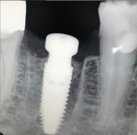 4M Dental Implant Center image 4