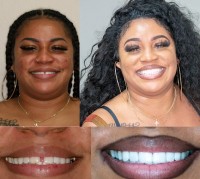 4M Dental Implant Center image 3