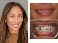 4M Dental Implant Center image 2