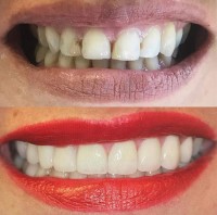 4M Dental Implant Center image 1