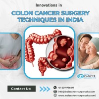 Top Oncologist For Colon Cancer India image 1