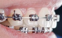 Super Orthodontics  image 5